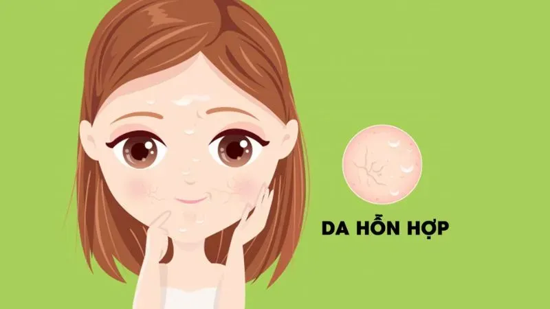 Cách chăm sóc da hỗn hợp