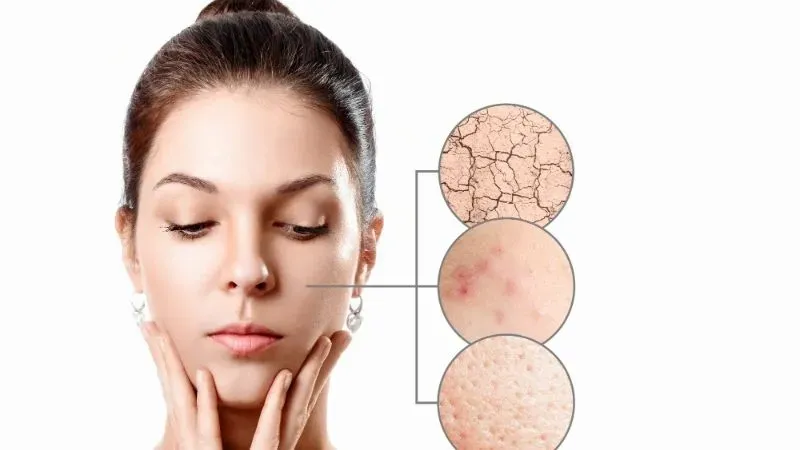 Các loại mỹ phẩm cho da hỗn hợp tốt nhất