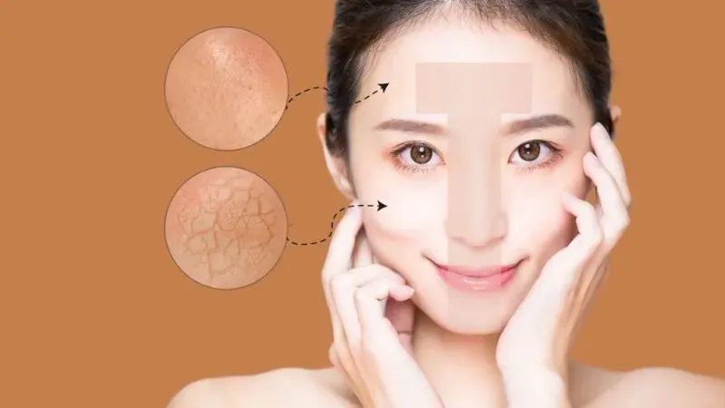 Dấu hiệu nhận biết da hỗn hợp