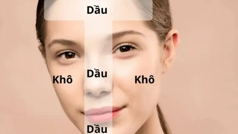 Cách chăm sóc da hỗn hợp