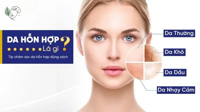 Da hỗn hợp là gì?