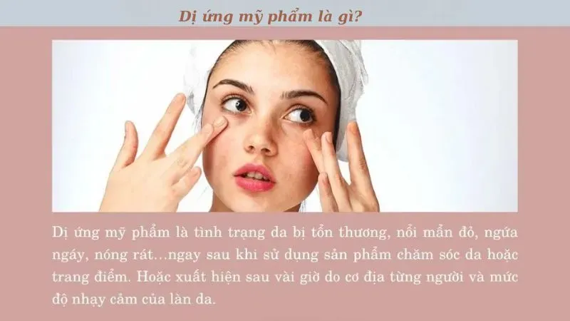 Dị ứng mỹ phẩm là gì?