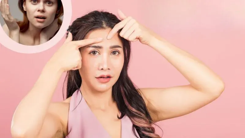 Những lưu ý khi chăm sóc da mụn