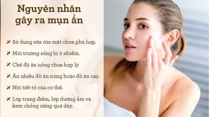 Vì sao da mụn cần được chăm sóc cẩn thận