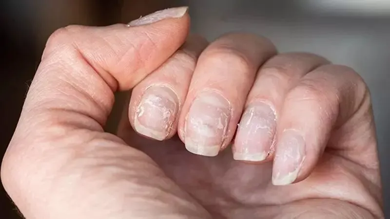 Cách chăm sóc móng tay yếu và dễ gãy 