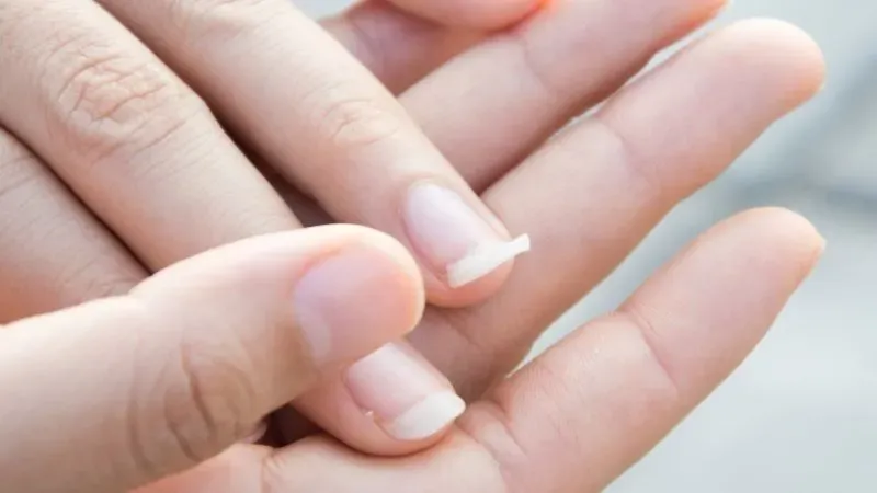 Cấu tạo của móng tay như thế nào?