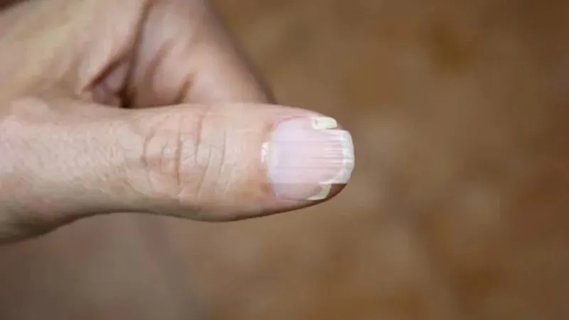 Chức năng của móng tay là gì?