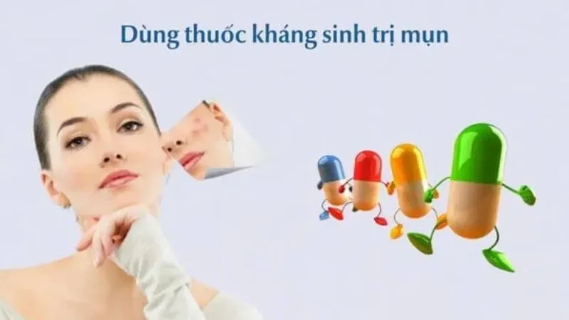 Cách điều trị mụn nội tiết