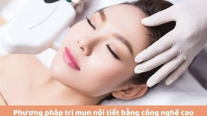 Cách điều trị mụn nội tiết