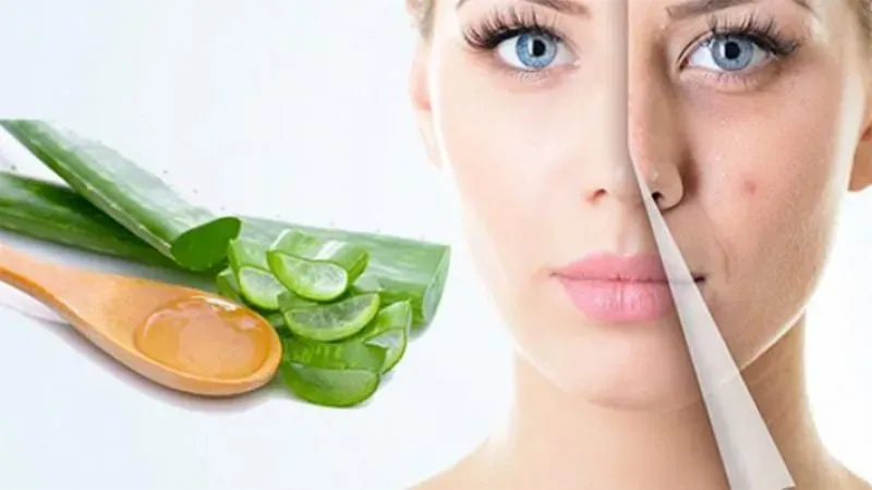 Các loại thực phẩm tự nhiên làm giảm mụn thâm các vùng 