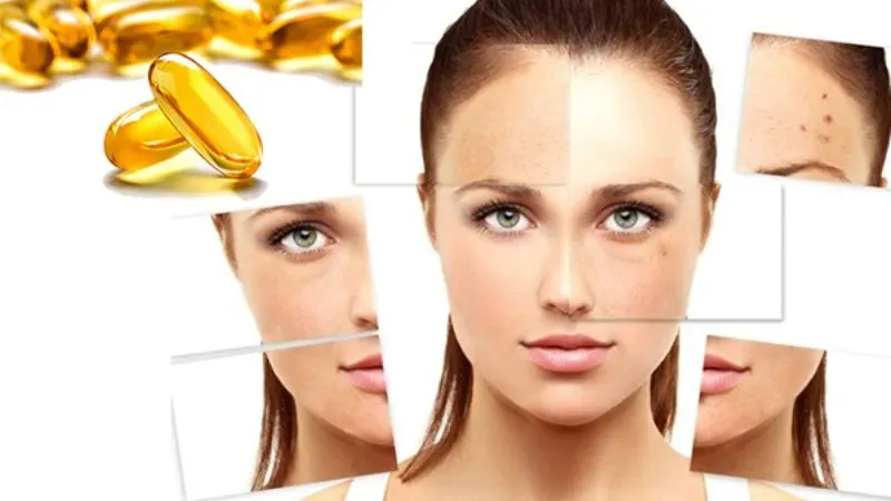 Top 12 cách trị thâm mụn từng vùng hiệu quả an toàn