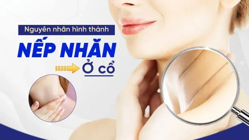 Nguyên nhân xuất hiện nếp nhăn ở cổ?