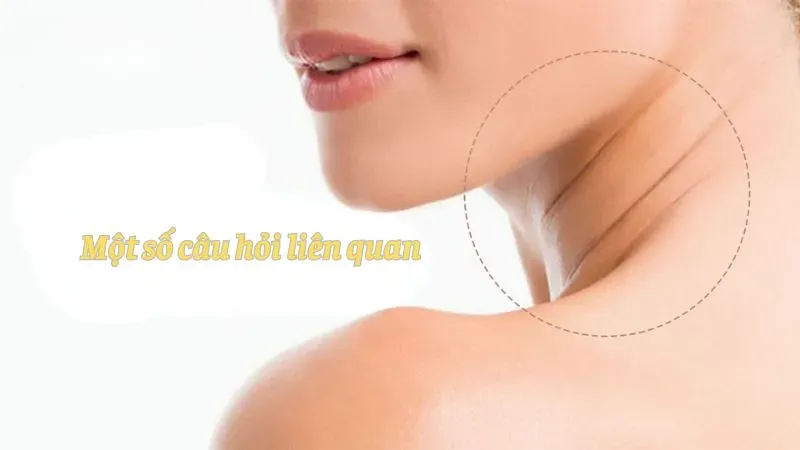 Một số câu hỏi liên quan