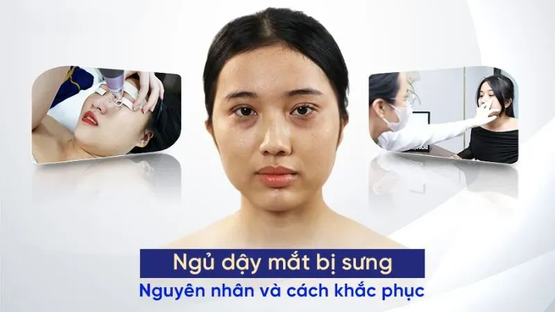 Nguyên nhân gây sưng mắt khi ngủ dậy