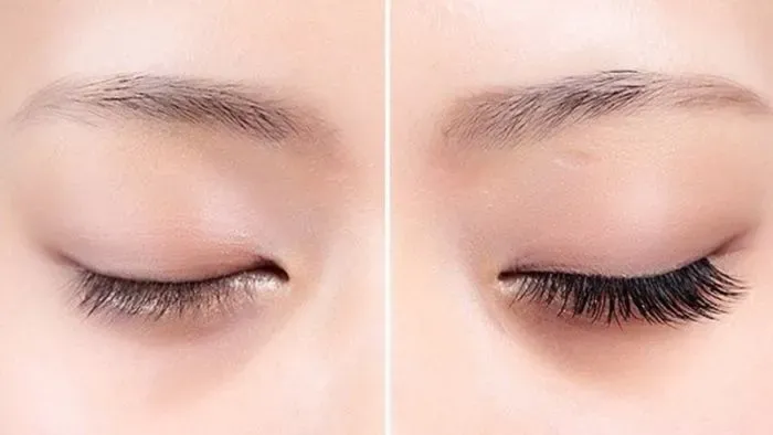Nguyên nhân khiến lông mi ngắn, thưa