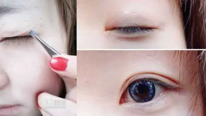 Những lưu ý khi chọn phương pháp 