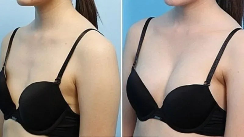 Kích thước ngực như thế nào là to? 