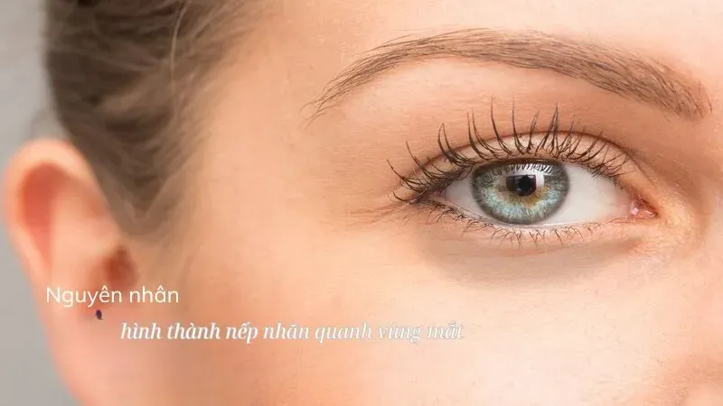 Nguyên nhân hình thành nếp nhăn quanh vùng mắt