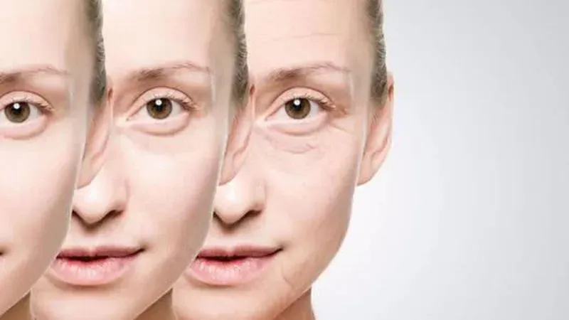 Nếp nhăn ở vùng mắt có xóa được không?