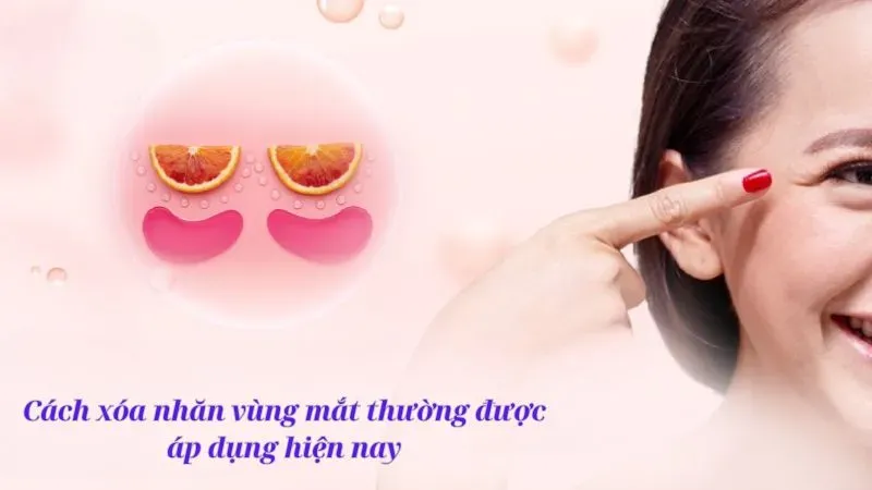 Cách xóa nhăn vùng mắt thường được áp dụng hiện nay