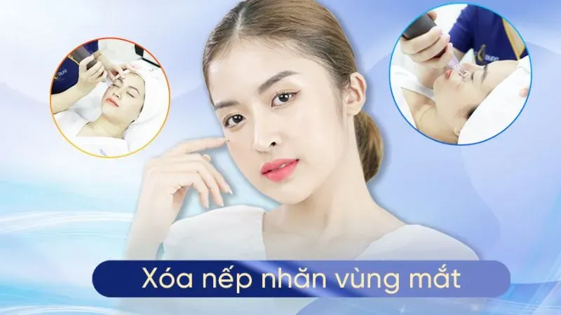 Cách xóa nhăn vùng mắt thường được áp dụng hiện nay