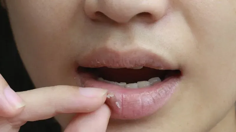 10 loại dưỡng môi được ưa chuộng nhất hiện nay