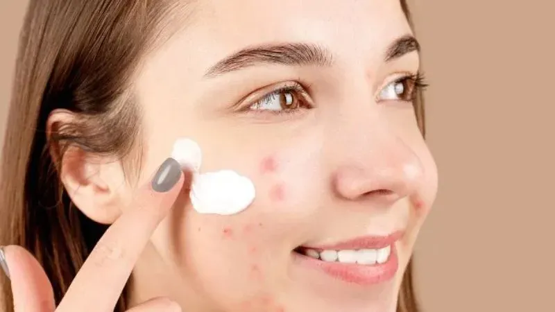 Những điều cần lưu ý khi lựa chọn trị mụn bọc tại nhà