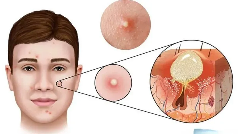 Khi nào cần gặp bác sĩ?