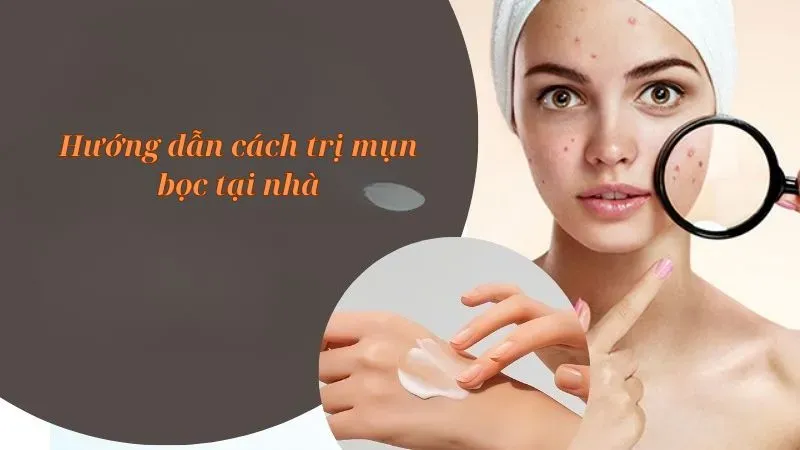 Hướng dẫn cách trị mụn bọc tại nhà