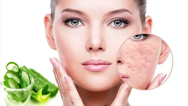 7 phương pháp trị sẹo rỗ hiện đại và chuyên nghiệp