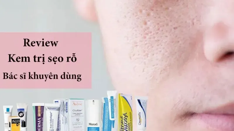 Các sản phẩm bôi ngoài da hỗ trợ điều trị sẹo rỗ hiệu quả