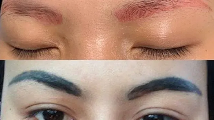 Cách khắc phục chân mày trổ xanh