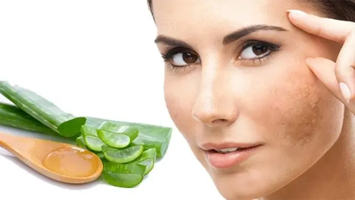 Ưu điểm và nhược điểm của việc điều trị nám da tại nhà