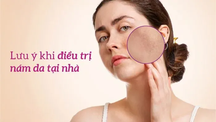 Lưu ý khi điều trị nám da tại nhà