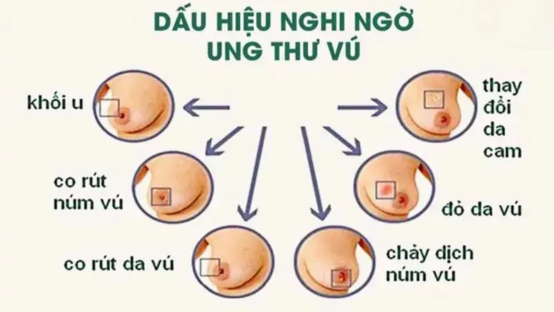 Các nguyên nhân gây đau vòng 1