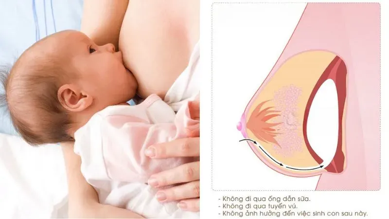 Những lưu ý khi bổ sung sữa công thức cho trẻ