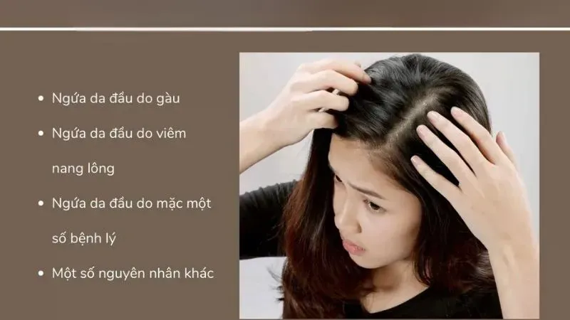 Nguyên nhân gây da đầu ngứa và gàu