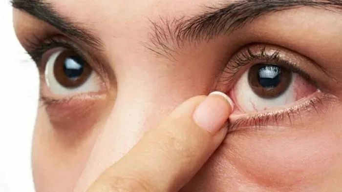 Cách khắc phục và điều trị