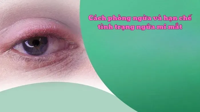 Cách phòng ngừa và hạn chế tình trạng ngứa mi mắt