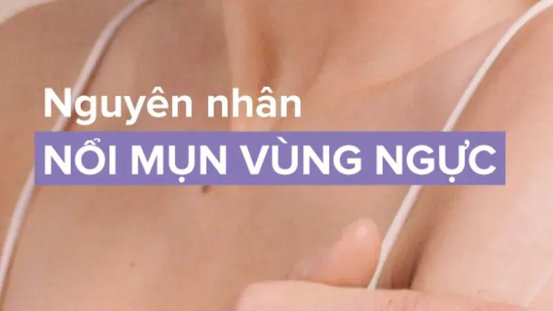 Nguyên nhân gây mụn ngực