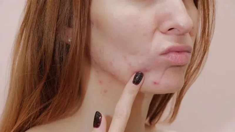 Tác hại khi sử dụng mỹ phẩm hết hạn