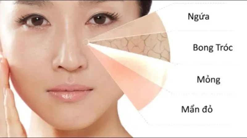 Tác hại khi sử dụng mỹ phẩm hết hạn