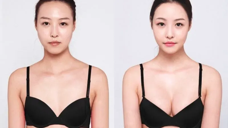 Các yếu tố quyết định đến kích cỡ vòng 1