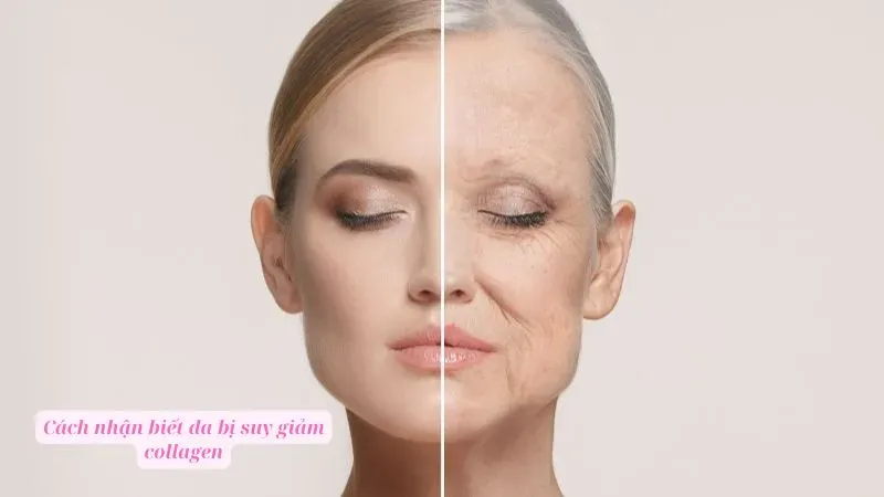 Cách nhận biết da bị suy giảm collagen