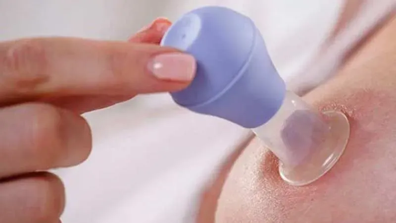 Sự nguy hiểm khi vòng 1 không có núm vú