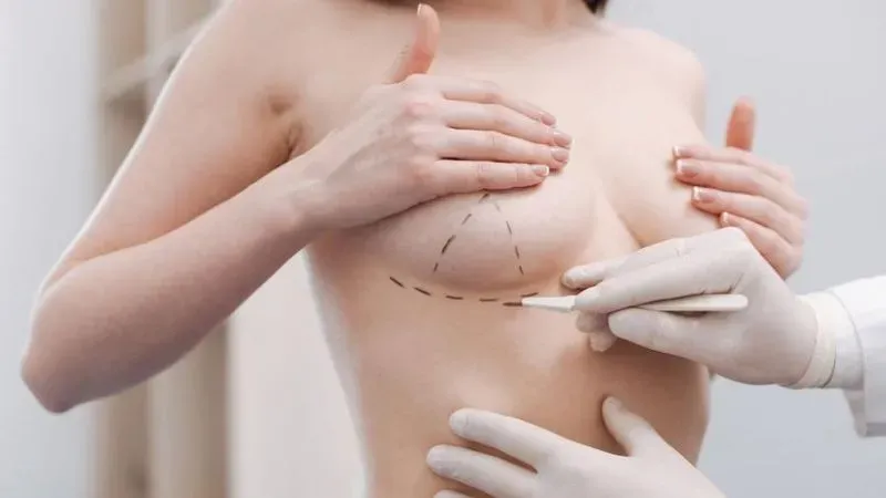 Các mức độ tụt núm vú và phương pháp can thiệp