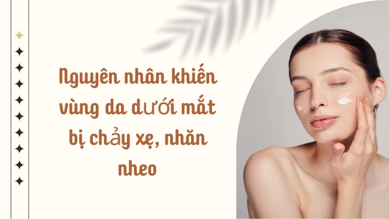 Nguyên nhân khiến vùng da dưới mắt bị chảy xệ, nhăn nheo