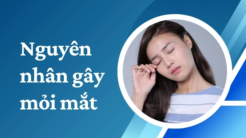 Nguyên nhân gây mỏi mắt