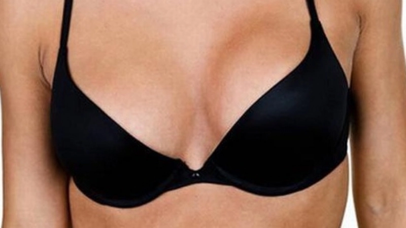 Ngực phát triển không đều hai bên