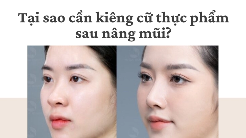 Tại sao cần kiêng cữ thực phẩm sau nâng mũi?